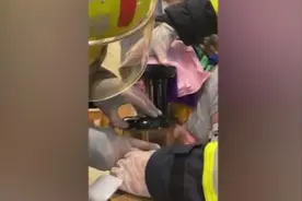三岁男童手伸进榨汁机，三根指受伤需植皮视频封面