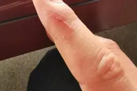 鱼能咬伤人？这是真的！提醒：养这些鱼要懂它们，不然真会被咬伤图片