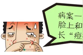 【爱肤日】战“痘”神器，火针疗法+中药汤剂，让你与“青春痘”轻松说拜拜图片