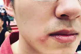 路子野？刘昊然拍《我和我的家乡》被蜜蜂蛰图片
