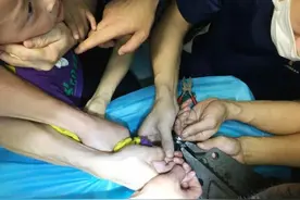 湖北鄂州：男童手指卡钢圈两小时肿胀发紫 家长凌晨驱车救助消防成功救援图片