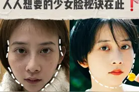 面部填充后，脸上出现了小硬块？响当当的大医院也会手术失败？图片