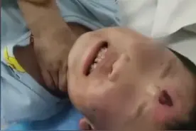建三江遭“继母”虐打4岁女童苏醒，舅舅称还不能说话图片