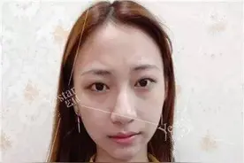 济南艺星双眼皮怎么样？看她就够了！（清纯女大学生秒脱单）图片