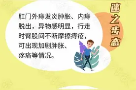痔疮该不该手术？医生告诉你真相图片