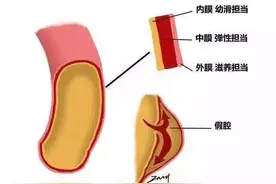 【注意】深圳男子上厕所突感胸口剧痛，双腿无法动弹！这几类人易发，危及性命图片