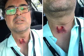 谢明皓：美国警察一枪射瞎记者，真的只是失误吗？图片