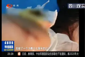 江西：停车场起落杆划伤小孩 该谁负责？图片