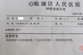 心塞 驾考模拟考试车辆直接冲进树林 后排观摩学员鼻骨骨折图片