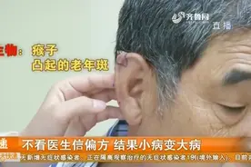 大连：大爷耳朵上长了个瘊子，不去医院反而用偏方，差点出大事儿视频封面