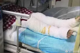 深圳女子在家被雷电击伤调查进展：初步推测遭遇球状闪电图片