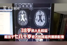 38岁男子被查出“痴呆晚期”，罪魁祸首意想不到...图片