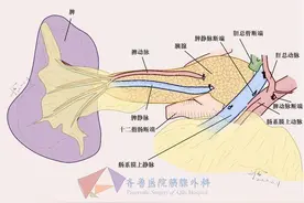 壹点医典｜56岁女性大便中可见“油花”，原来是得了这种病图片