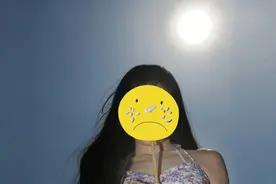 夏季警惕日光性皮炎，先做好防晒，这类食物也要少吃图片