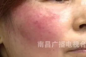 南昌女子花9000元美容！结果让她后悔不已……图片