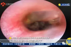 女子突然听不见声音！医生从她左耳里取出蚕豆大的…黄梅天你得注意图片