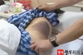 75岁老太学别人“撞树养生”缓解腰痛，结果却吓人图片