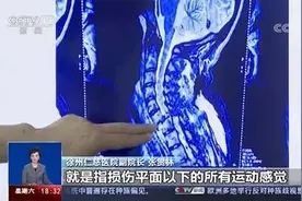 蹦床运动又出事：大哥背对跳入海绵池摔至胸椎骨折图片