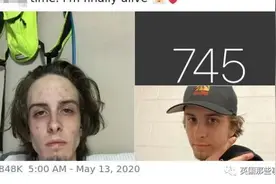 小哥戒毒745天后晒出对比照，84万网友点赞：珍惜生活，远离毒品图片