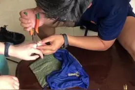 戒指卡得手指肿胀发紫 女子到市消防救援大队求助图片