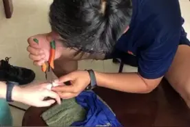 戒指卡得手指肿胀发紫 女子到市消防救援大队求助图片
