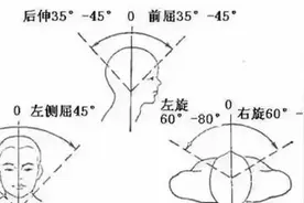 广州女子坐过山车扭了脖子！这类人群慎玩，严重可致瘫图片