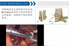 五莲县人民医院泌尿外科团队：取得新突破，再上新的台阶图片
