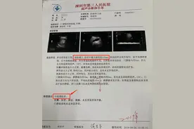 11岁男孩得重度肝硬化！家长蒙了：从小的“健康”习惯竟害了他图片