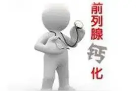 「父亲节科普」体检发现前列腺钙化怎么办图片