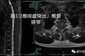 走路不稳，平地摔跤，是腿有毛病吗？不一定图片
