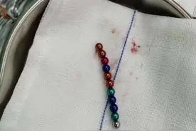 家长当心！2岁孩童误食磁力珠致胃肠穿孔，这种玩具不要再给孩子玩了图片