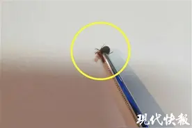吓人！蜱虫钻进3岁女童耳道，还产了卵图片