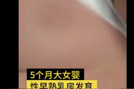 5个月大女婴性早熟致乳房发育，医生诊断激素过高，家长怀疑祸首是它图片