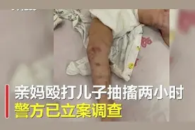 成都一岁娃被亲妈殴打进ICU，医生称娃到时已抽搐两小时，警方通报了图片