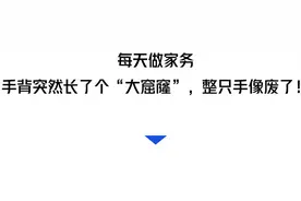 女子手背长出大窟窿，差点截肢！只因这个家务活…图片