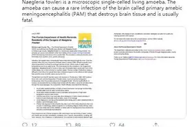 可怕“食脑虫”入侵美国？能从鼻腔进入感染大脑图片