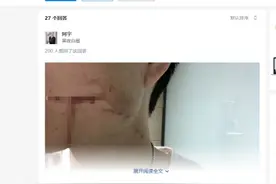 26岁男子拔智齿流血10多天后离世，专家：他有白血病但自己不知道图片