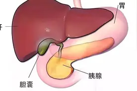胆囊切除术后需要注意哪些？图片