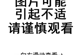 家长注意！福州2岁男童手臂被绞断！凶器很常见图片