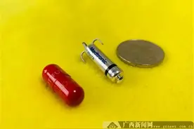 广西首例！自治区人民医院无导线起搏器植入术成功实施图片