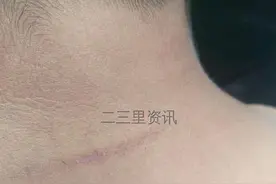 大荔6年级男生遭遇校园霸凌 家长发现被褥上有大片血迹图片