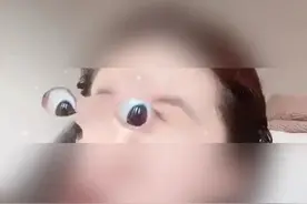 太可怕！模仿视频特效，6岁男孩把自己眼球抠突出来了图片