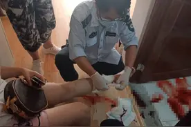 最担心的事儿来了！如厕时马桶突然爆裂，她缝了20多针图片