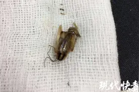 虫子进耳朵了怎么办？在线等，挺急的图片