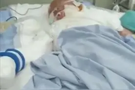 痛心！绍兴一培训班6个孩子被烧伤！正在ICU抢救的男孩，爸妈已认不出他的样子……图片