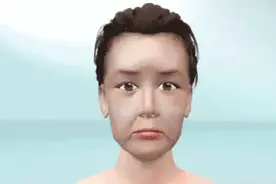 美容成“毁容” ？金山的医美机构靠谱吗？图片