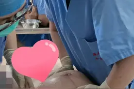 “乾坤大挪移”！39周臀位宝宝在妈妈肚里“转正”顺产图片