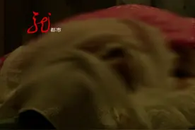父亲的头皮，被成功移植到了女儿身上！小姑娘哭了：对不起爸爸图片