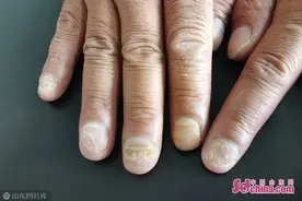 真爷们！徒手掰断3根钢筋火场救人，他退役不褪色图片