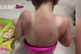 孩子多晒太阳好？女童海边游玩晒伤 儿童防晒更讲究图片